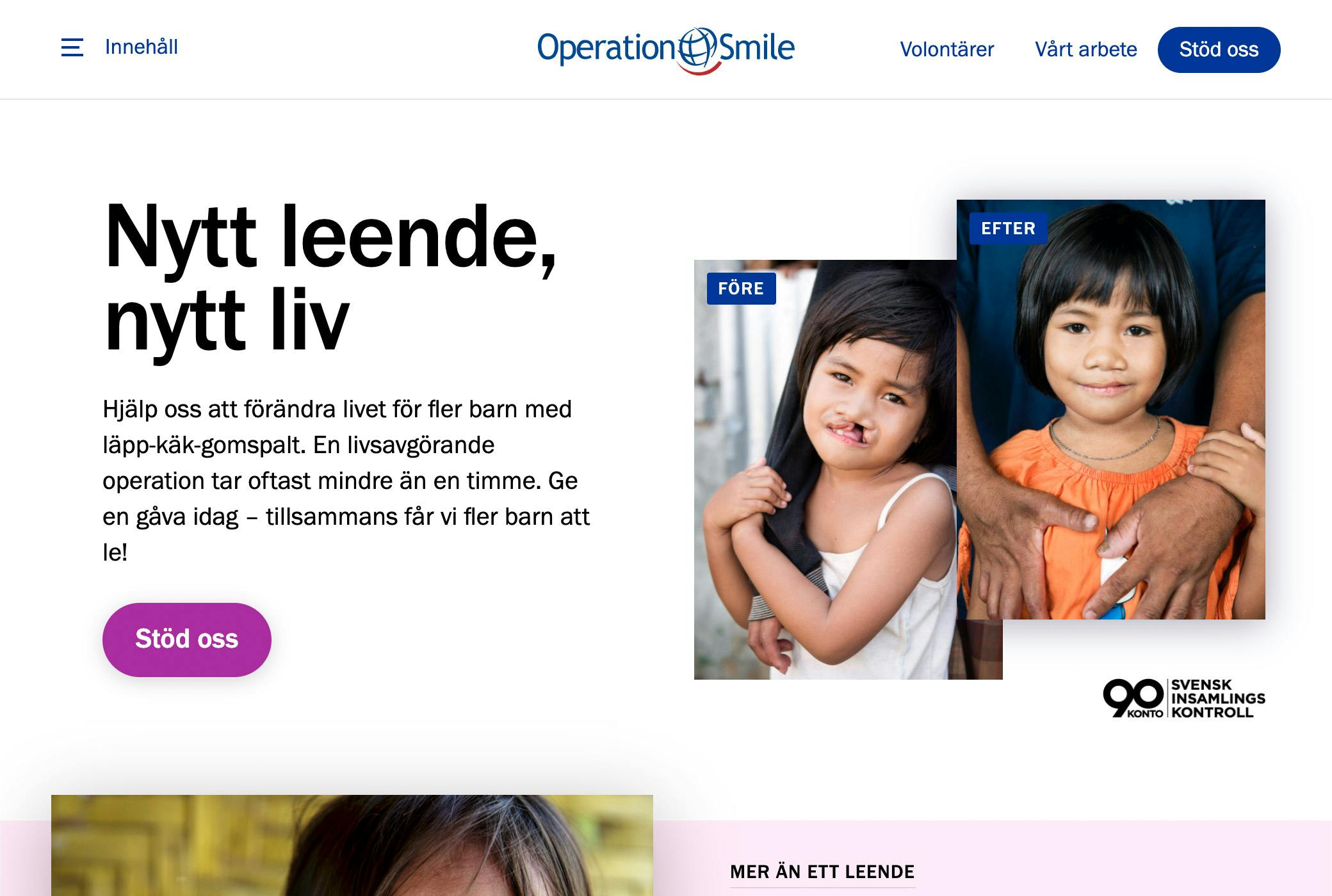 Operation Smile’s Website